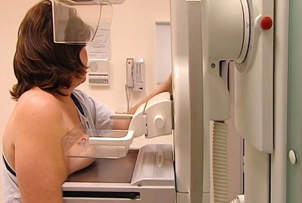 Woman receiving a mammogram, part of cancer risk prevention screening