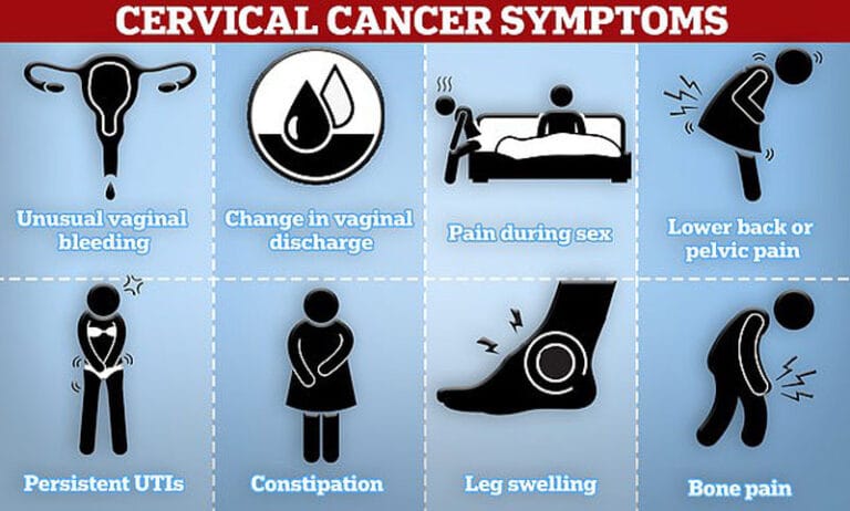 Cervical Cancer Symptoms Daily Mail Online