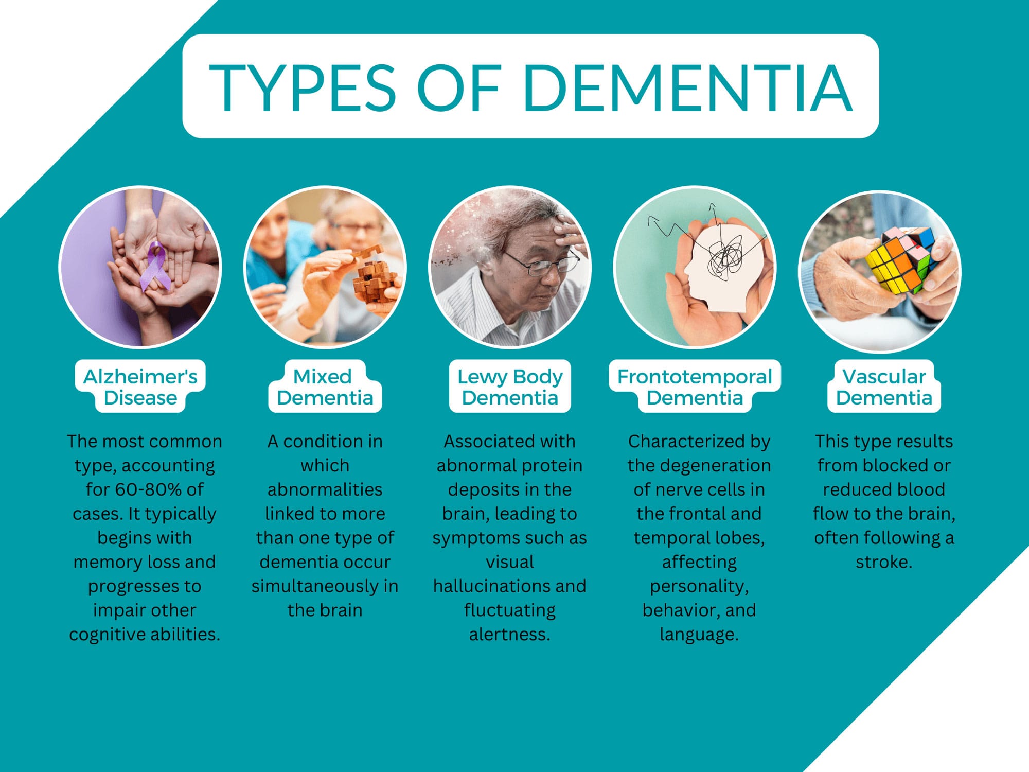 Lifestyle Changes Types of Dementia Image