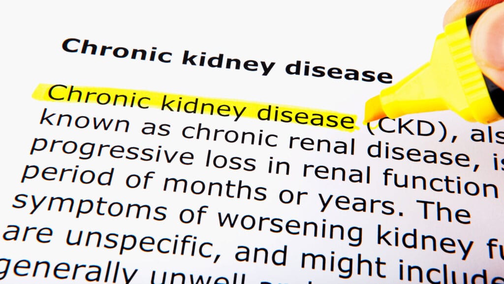 Chronic Kidney Disease Image